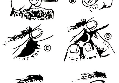 Gallery Post With Image List | STEVEN R. YOUNG, OCULARIST, INC.